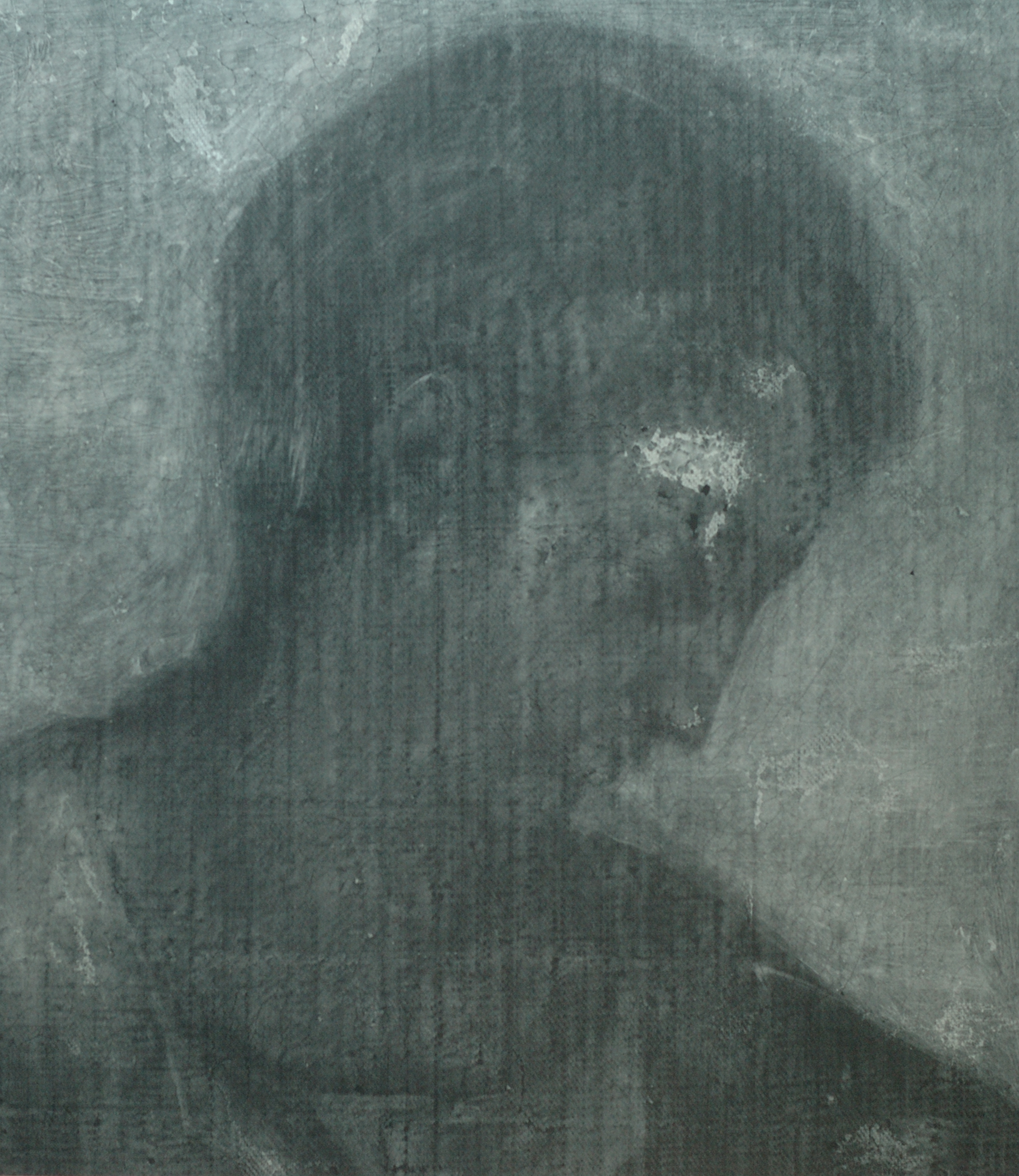 Radiographie de la tête